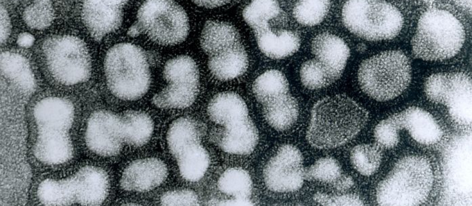 Nuevo estudio para cuantificar el impacto real de la gripe y otras infecciones respiratorias en la mortalidad